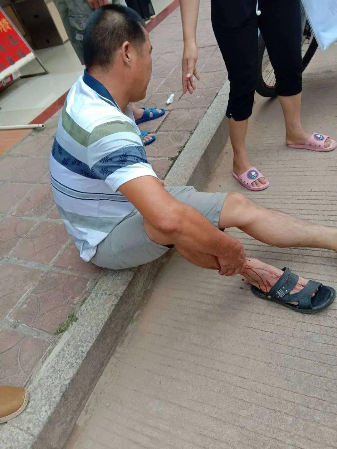 华城环城街两辆摩托发生碰撞,一人腿部受伤.