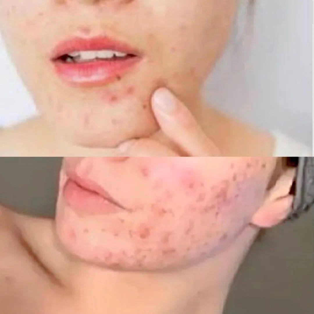 精华|高浓度护肤猛药，我的魔鬼CP！