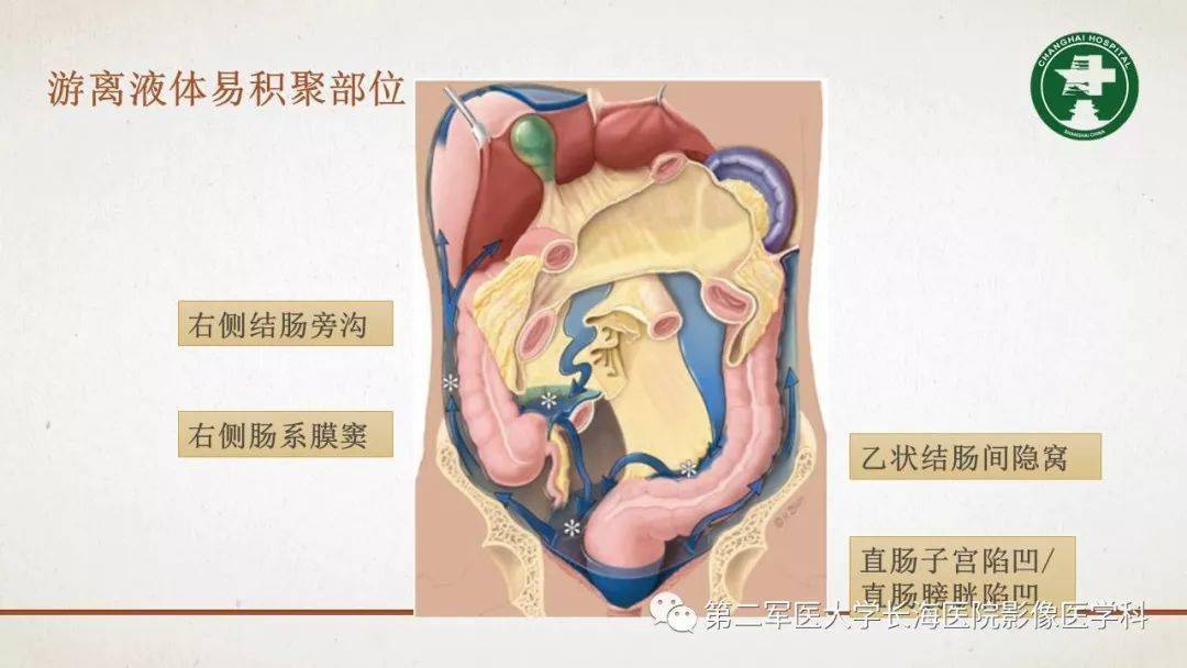 腹膜相关结构的影像解剖_肠系膜