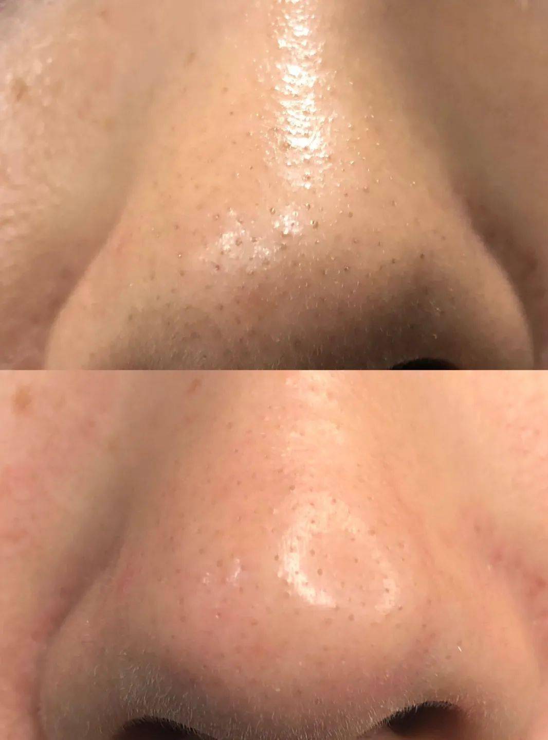 角质|能搓出“脏东西”的它3秒卖出一瓶！去角质、黑头、收毛孔，给你肌肤来次“大扫除”!