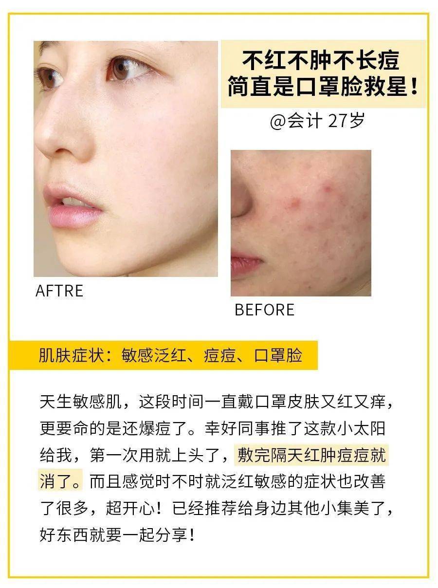 肌肤|40岁的逆袭 聪明的女人保鲜用这招