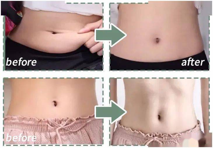 肚脐|想穿什么就穿什么的自信丨好物