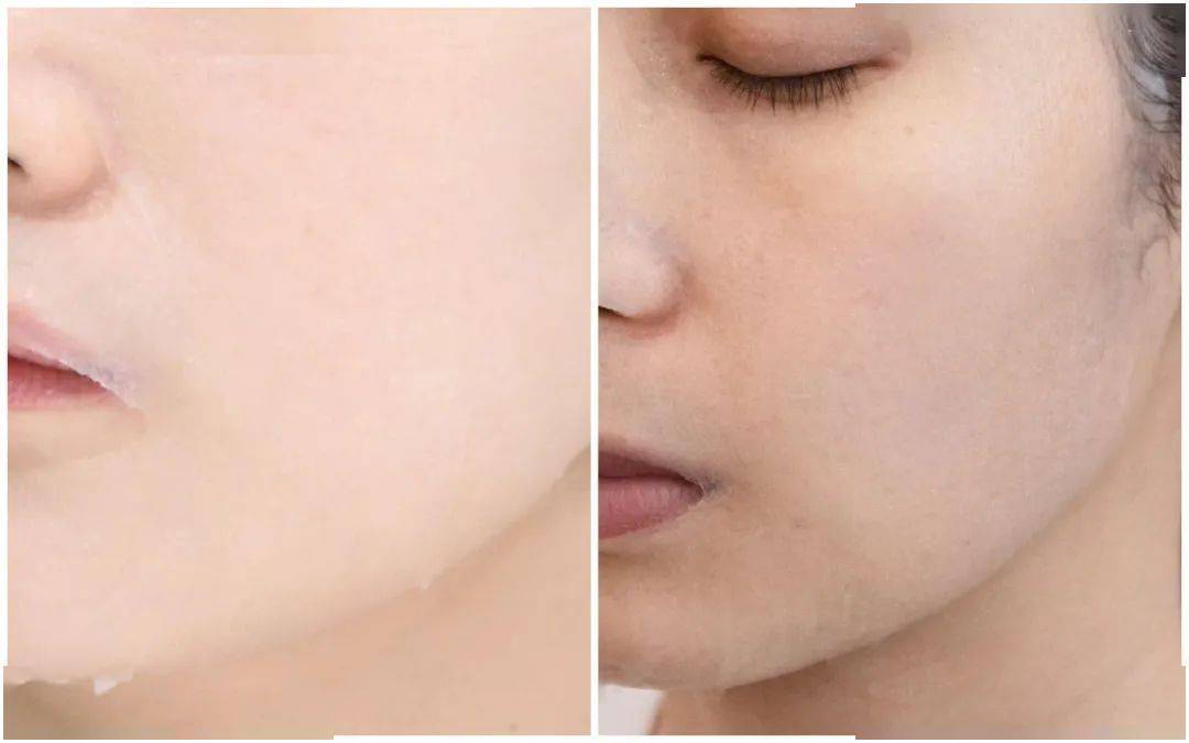 面膜|推广||她们说：这5件好物值得无限回购！