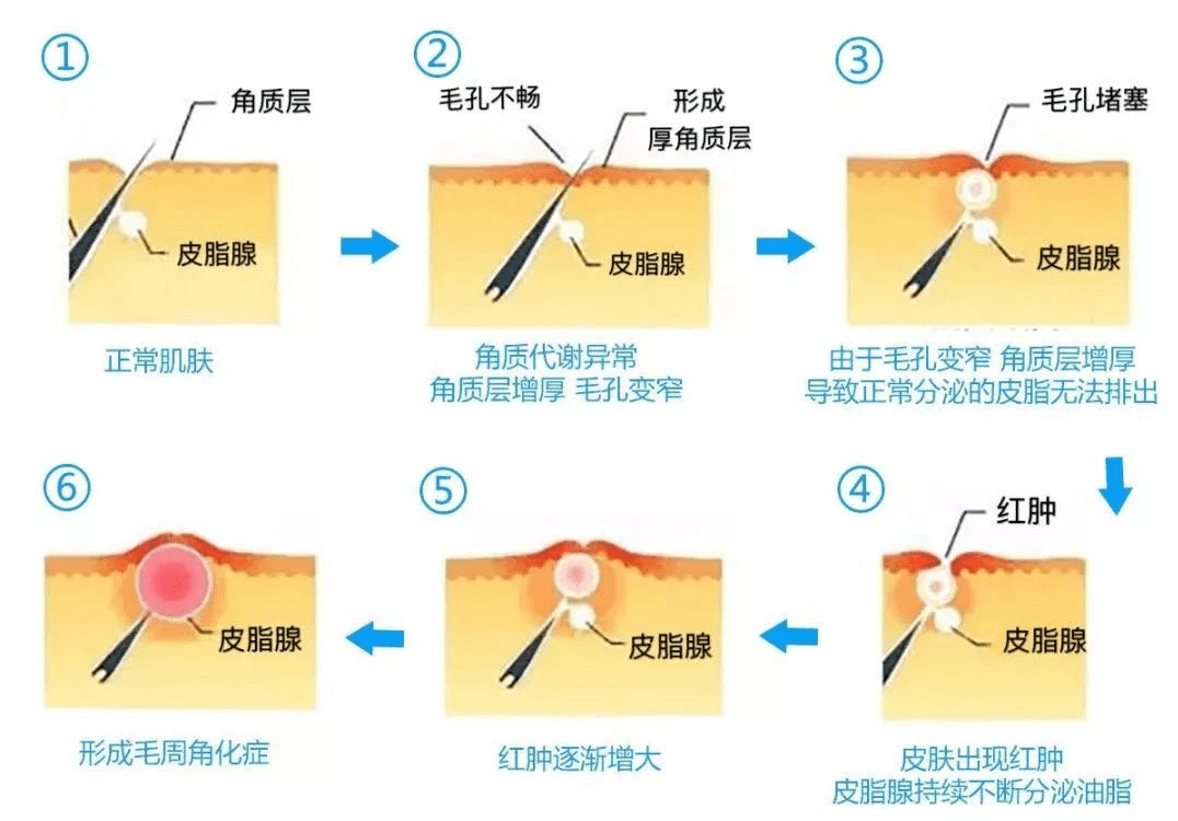 夏天|精致女孩就是要照顾到夏天露出的每一寸肌肤!