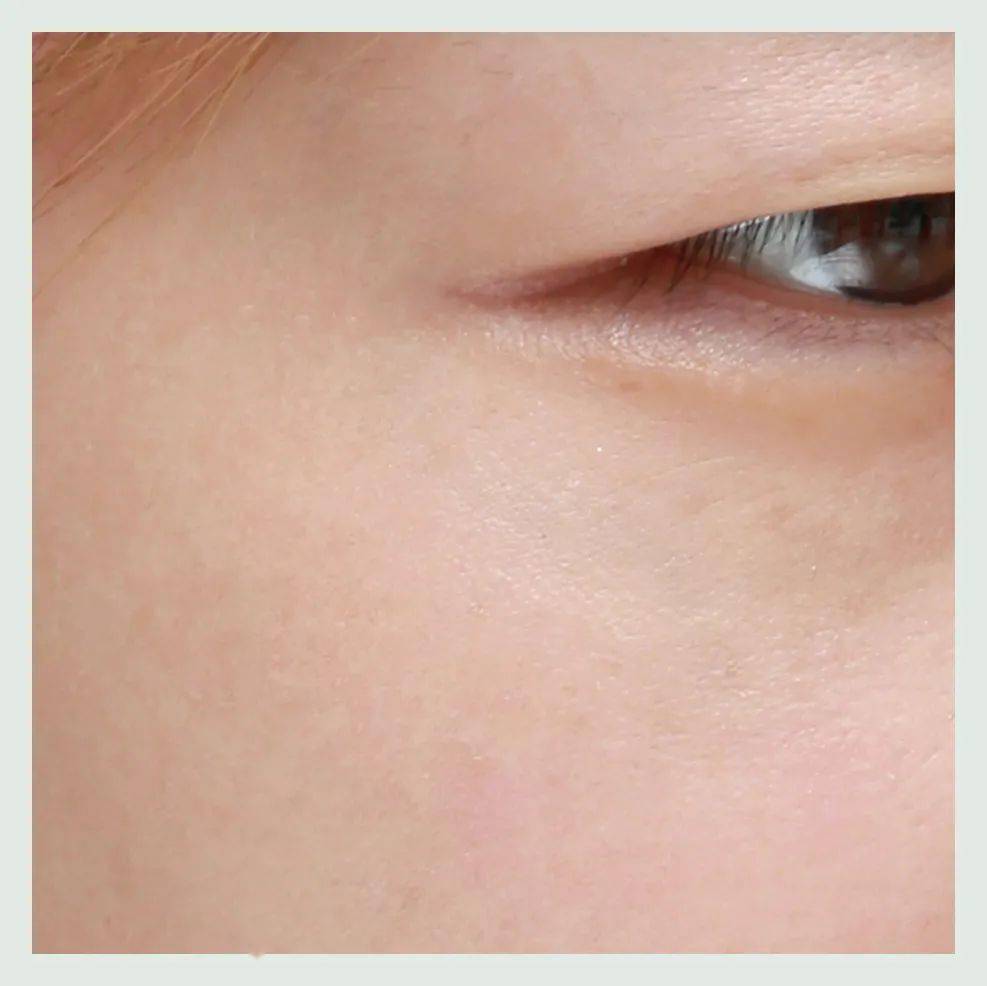 黑色素|广告商特别叮嘱我们，这篇推送的图片不许PS