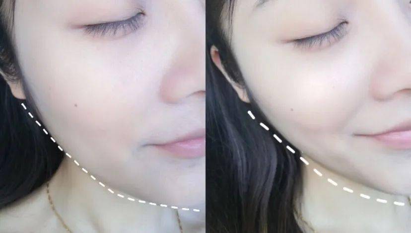 效果|这个比瘦脸针还好用的好物，既消水肿又提拉紧致，立变小V脸！