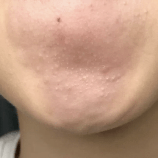 皮肤|纯分享：我最爱的11款小众面膜都在这了！