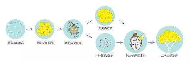 姐姐|乘风破浪的姐姐火了，没想到这些医美项目竟然也火了！