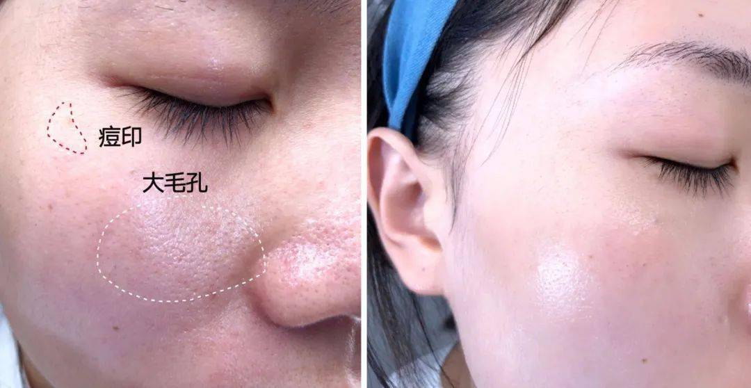 张天|张天爱比杨幂会“撩”?让小奶狗痴迷的她,到底有啥不一样?