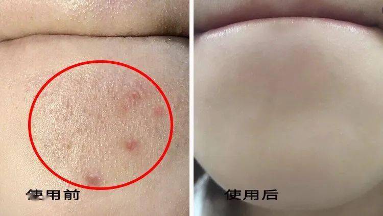 张天|张天爱比杨幂会“撩”?让小奶狗痴迷的她,到底有啥不一样?