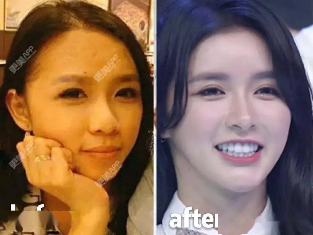 一张图出卖欧阳娜娜整形痕迹,16岁不到就do还吹纯天然