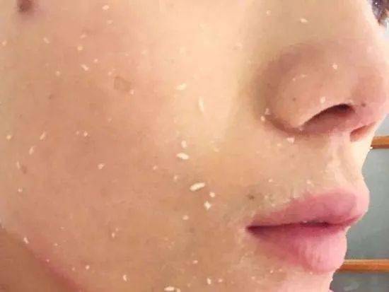 全是|是什么让一夜爆红的小花，直接上热搜？