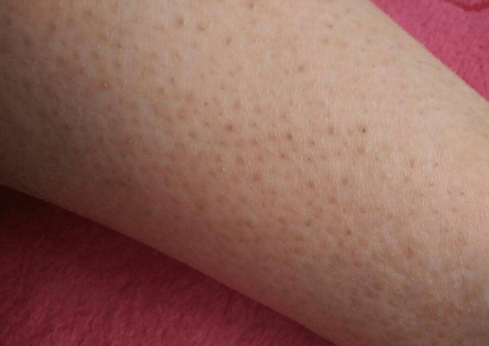 皮肤|想知道如何让肌肤常驻18岁吗？想知道明星三四十岁依然拥有靓丽肌肤吗？点进来我告诉你