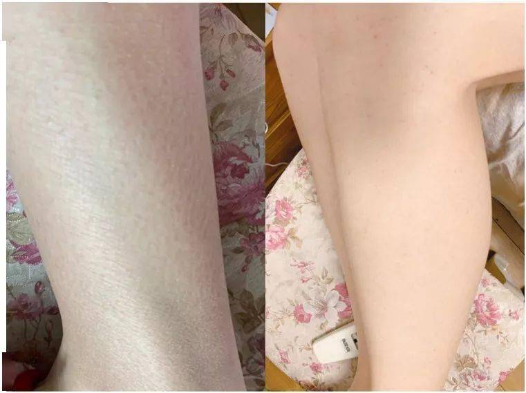 角质|薇娅吹爆的这款磨砂膏,我替你们试了,用完蚊子能在背上劈叉!