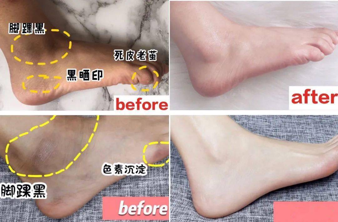 角质|薇娅吹爆的这款磨砂膏,我替你们试了,用完蚊子能在背上劈叉!