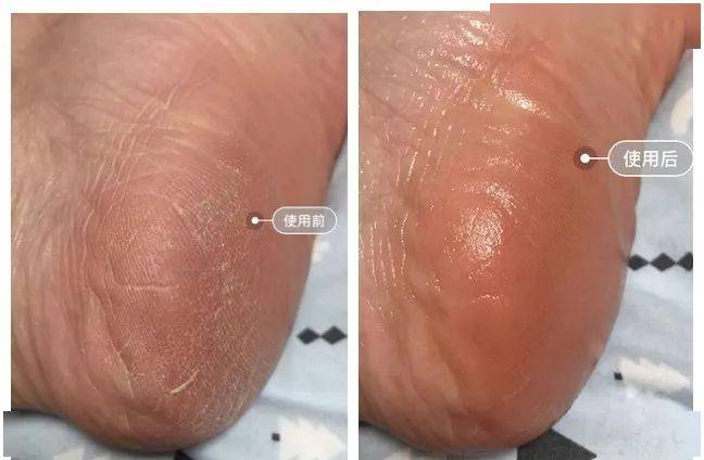 肌肤|30年老国货，别因便宜而嫌弃，一瓶用全身，真正实力派