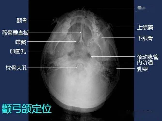 影像解剖 全身常规x线,骨关节mri断层解剖大全