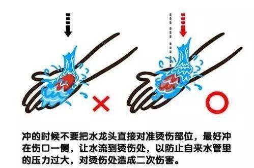 孩子|家属这样处理，差点让小孩送命......心疼~福建6月大女婴被开水烫伤