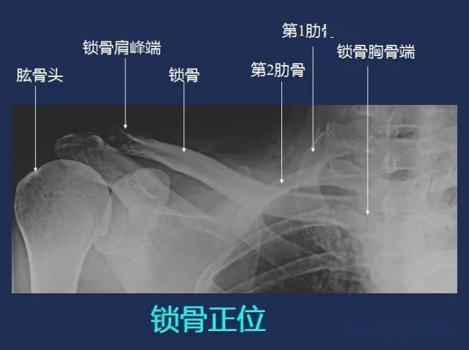 影像解剖全身常规x线骨关节mri断层解剖大全