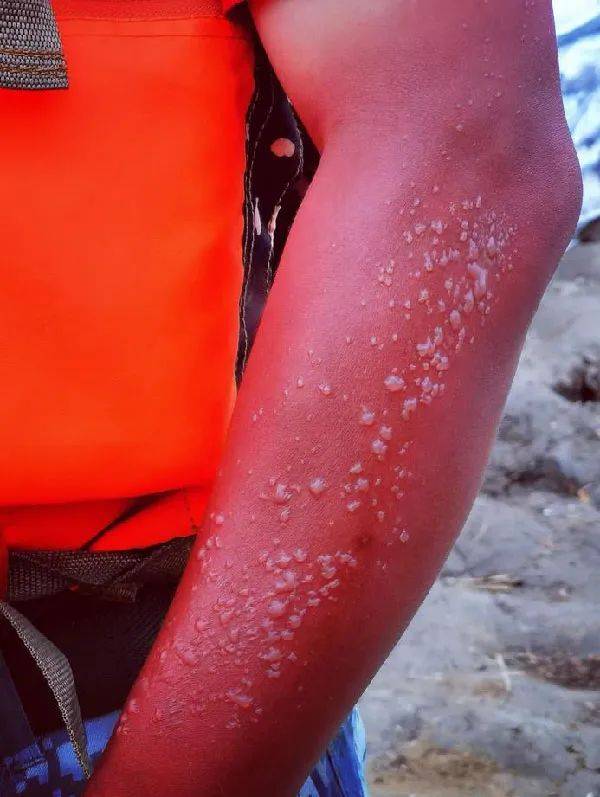 巡逻|没有一个标题，能承载他们的付出！