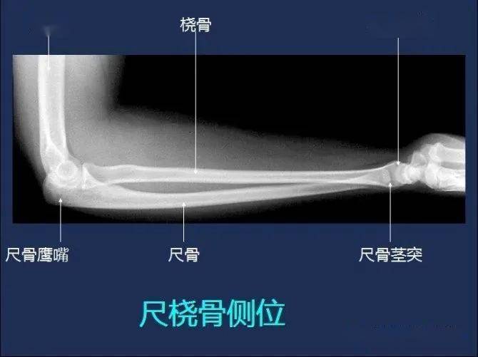 影像解剖全身常规x线骨关节mri断层解剖大全