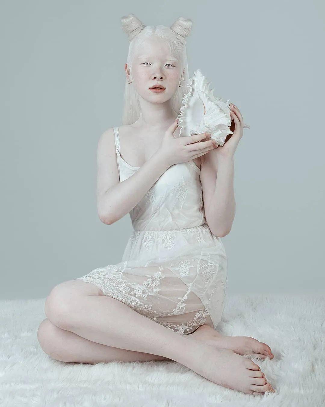 白化病姐妹罕见美照曝光，引6万粉丝赞叹：看一眼就忘不掉！