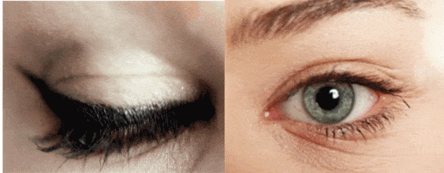 皱纹|抗皱抗衰老还在打针?用它赶走三八脸、鱼尾纹,让小朋友见到你都喊姐姐!