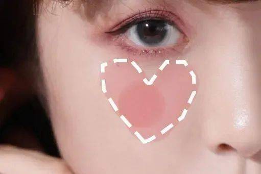 眼睑|手把手教学