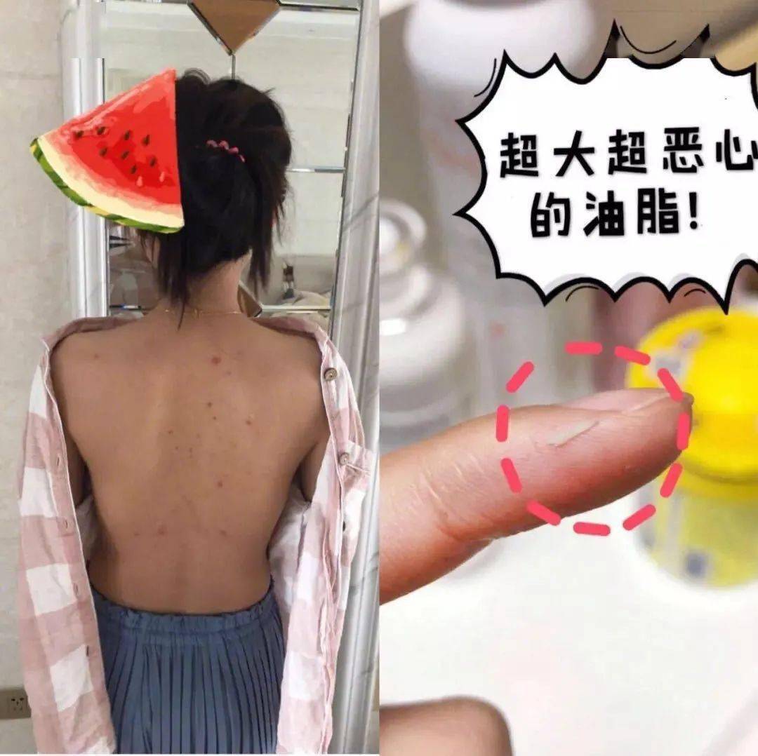 不知道|用1颗糖洗澡是什么体验？不洗都不知道身上这么脏，竟然还能扣出油脂粒！