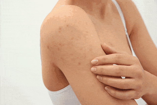 不知道|用1颗糖洗澡是什么体验？不洗都不知道身上这么脏，竟然还能扣出油脂粒！