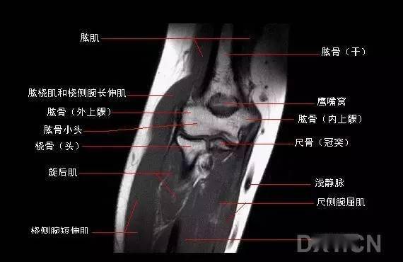 影像解剖肘关节mri图谱超全整理