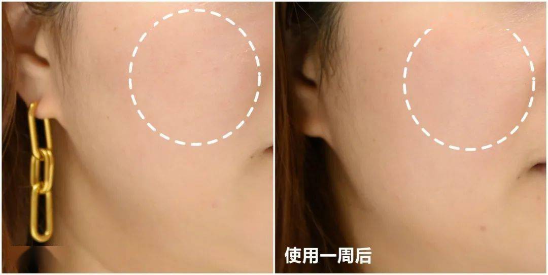 皮肤|推广|| 一生推的品牌又出新品了，预定下一个爆款！