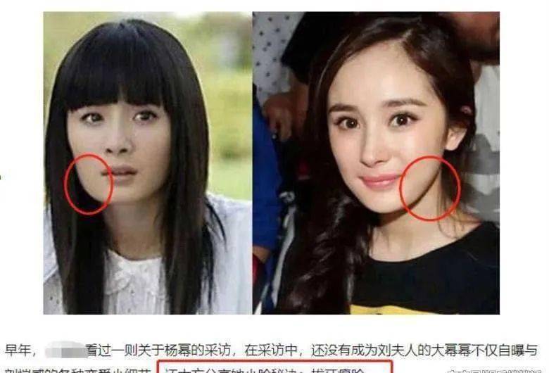 桃仔|整容黑历史都自曝了,景甜真是个狠人啊!