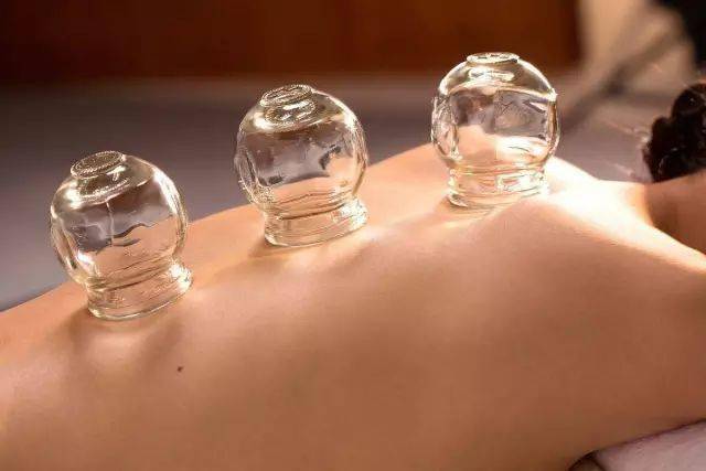 拔罐为什么疼得很 96f86db6a0fc458ea05464ce4b8ff5af.jpeg