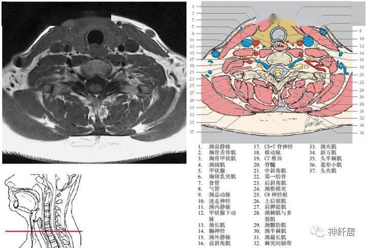 颈部详细的断层解剖