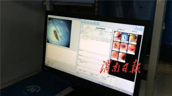 孩子|警惕“祸从口入”！儿童吞食异物 家长切莫大意