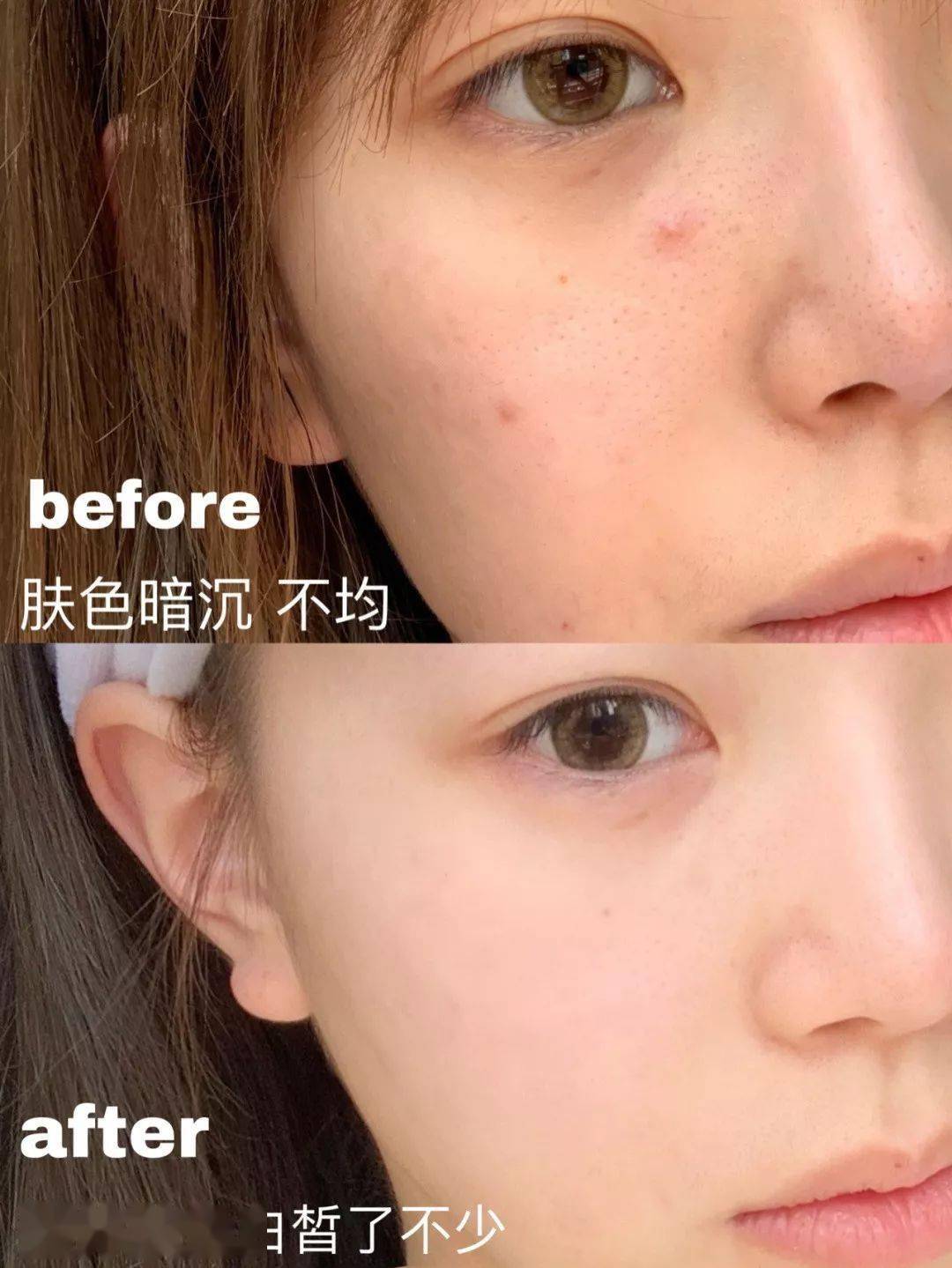 皮肤|43岁的李小冉“怼脸照”曝光，骗了所有人，冻龄女神根本不是天生的！