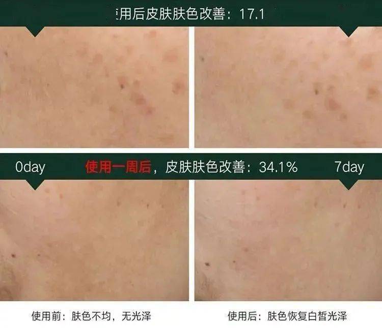 肌肤|40岁的年龄，18岁的脸，深扒“金喜善们”的冻龄术，竟然都是它！