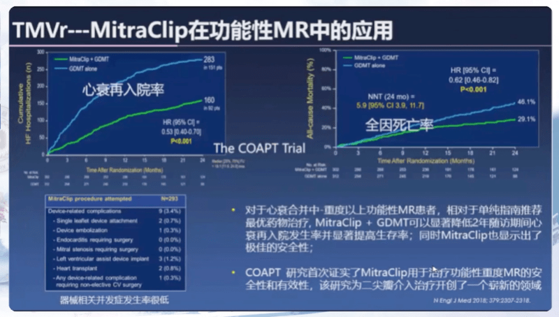 华教授|CCCP 2020｜周胜华教授：二尖瓣治疗术的未来新发展