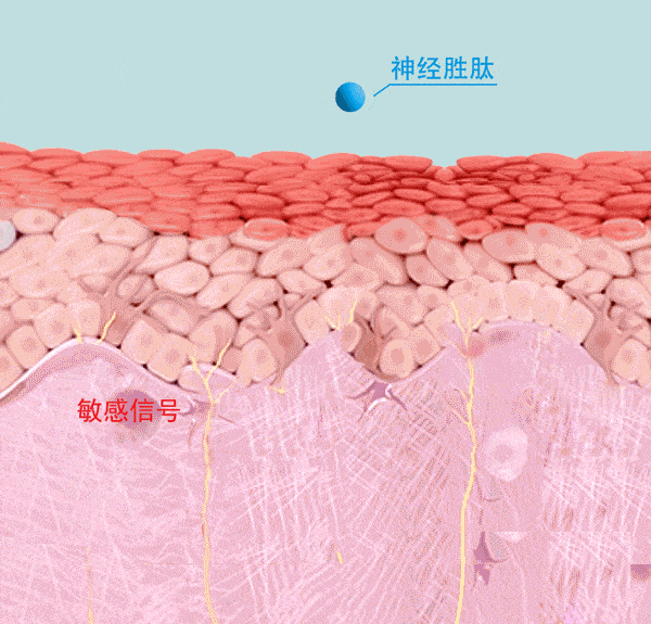 自救|皮肤敏感自救指南，找对原因才能轻松拯救！