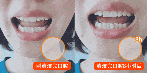 口腔|张嘴闭嘴还口臭？该怎么拯救？