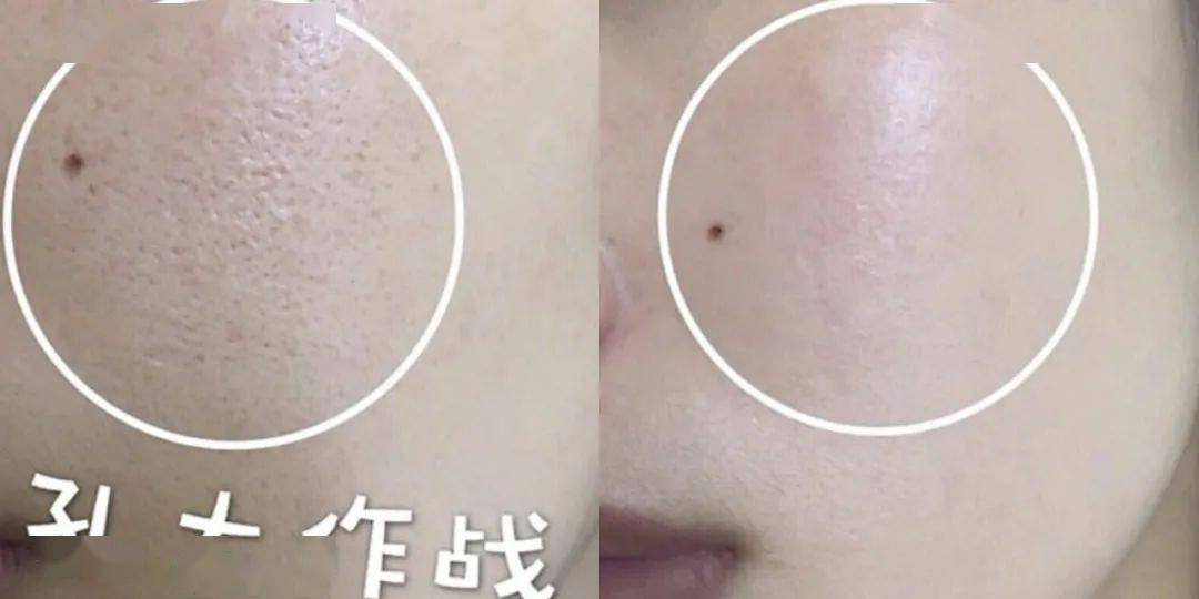 直播|“郑爽直播情绪失控大吵大闹?” 网友:求求你别再作了!