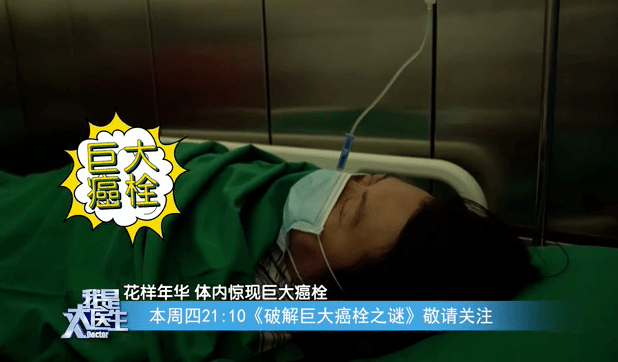 症状|16cm！年轻患者长出巨大癌栓，背后原因竟是“它”！出现这些症状需警惕