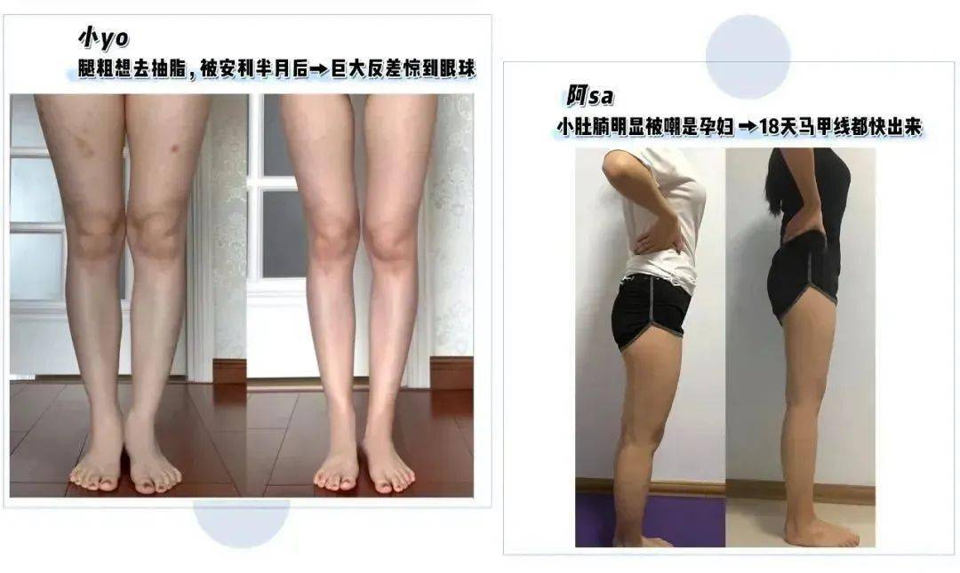 运动|“80斤的脸，120斤的腿”？魔力薇薇瘦腿裤来啦！全新升级千万不要错过！