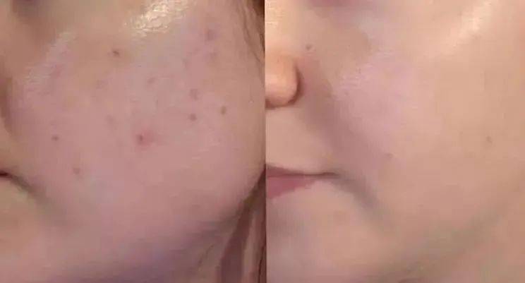 保养|张雨绮每月保养脸疑花70万，听了伊能静的金额……贫穷限制了我的想象