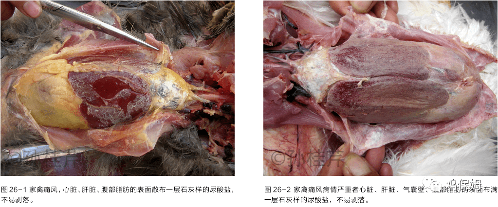 解剖可见内脏型痛风在胸,腹,气囊,肺,心包膜,肝,脾,肾,肠,及肠系膜的