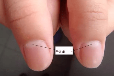 白点|孩子指甲上的月牙、白点、竖纹、分层、咬指甲......是有大病的征兆?