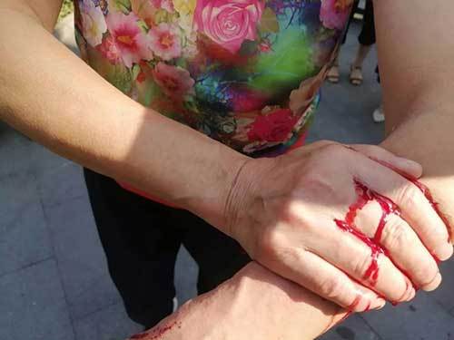 上海阿婆和孙女被十几楼坠下的重物砸伤，血洒