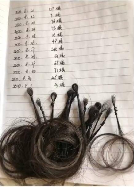 网友记录自己12天会掉多少头发…扎铁了老心