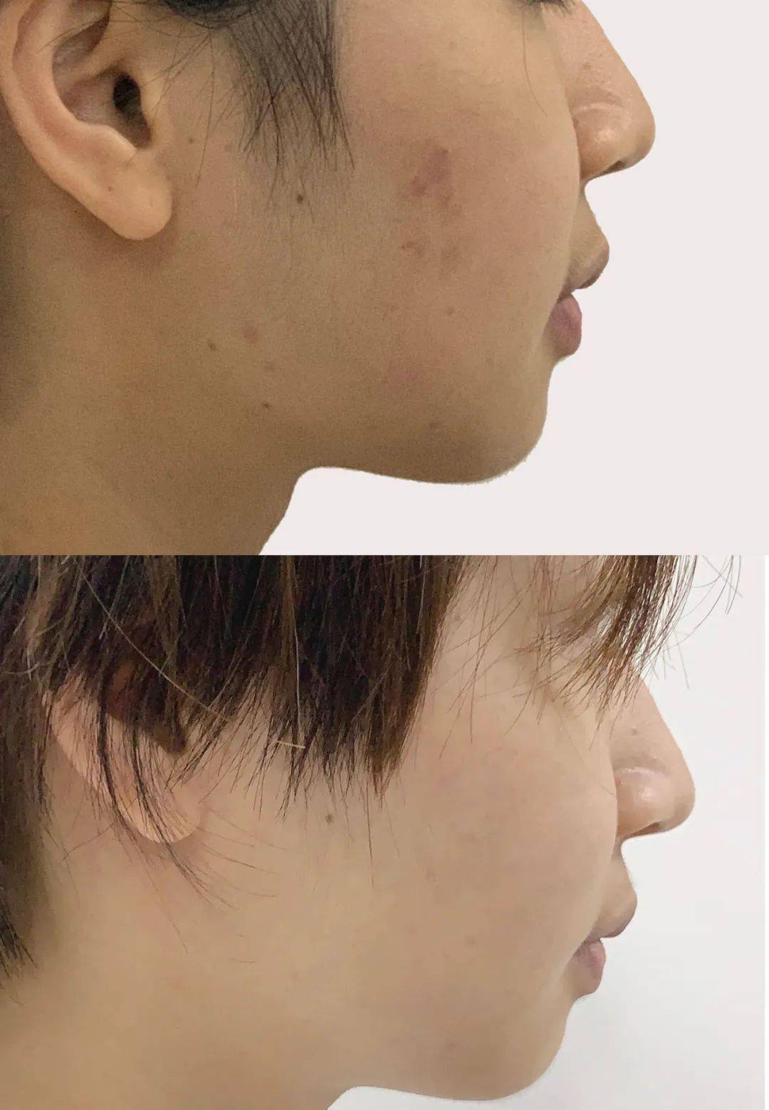 防晒力|“冯女郎”黑历史被扒？！被吹捧“高级”的钟楚曦，变美就靠这？